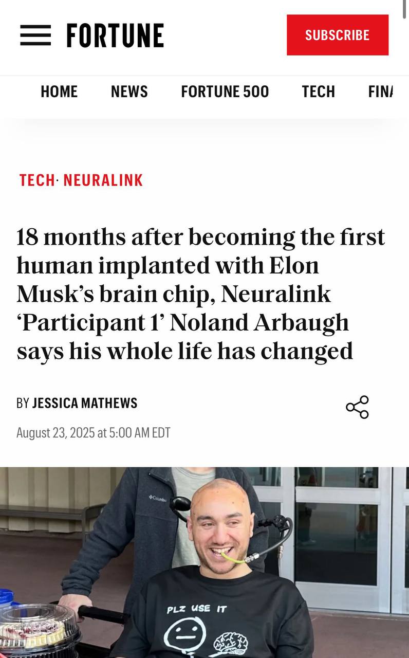 18 months after becoming the first human implanted with Elon Musk’s brain chip, Neuralink ‘Participant 1’ Noland Arbaugh says his whole life has changed.